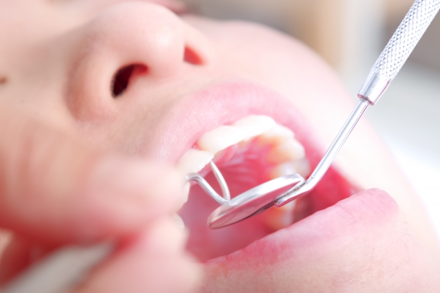 抜歯と同時にインプラントを埋め込む「即時埋入法」